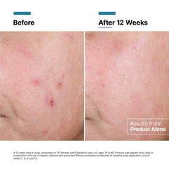 SkinCeuticals Advanced RGN-6 50ml - Crema Anti-Edad Post-Láser