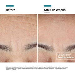 SkinCeuticals Advanced RGN-6 50ml - Crema Anti-Edad Post-Láser