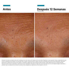 Skinceuticals HA Intensifier Multi-Glycan - 30Ml | Sérum Avanzado de Ácido Hialurónico