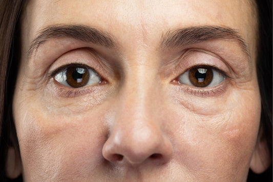 ¿Por qué el contorno de ojos es la zona más delicada y cómo darle el cariño que se merece?